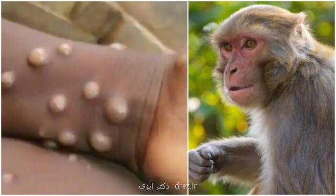 میزان اثرگذاری واکسن آبله بر آبله میمونی