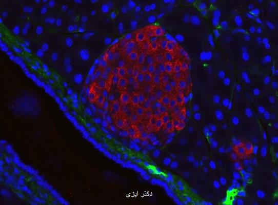 بازسازی سلول های بتا پانکراس و درمان دیابت