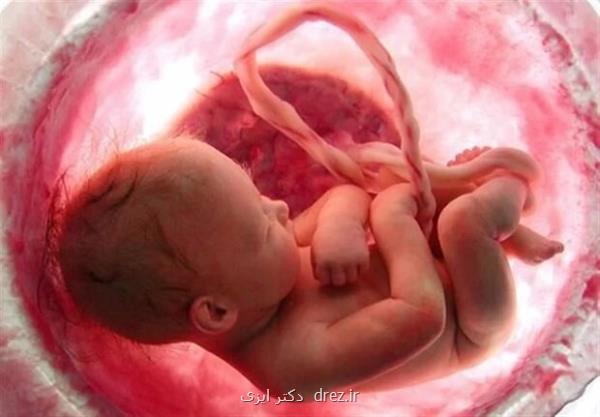 پره اکلامپسی در حاملگی باعث کندشدن روند رشد جنین می شود