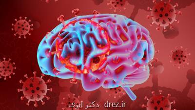كاهش ماده خاكستری مغز در بیماران كرونایی