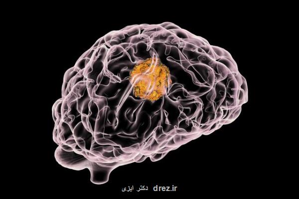 شناسایی مسیر جدید برای درمان تومور مغزی