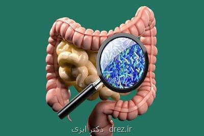 میكروب های روده بر شدت سكته مغزی تأثیر دارد