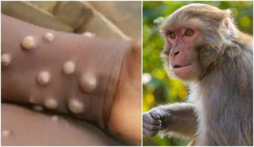 میزان اثرگذاری واکسن آبله بر آبله میمونی