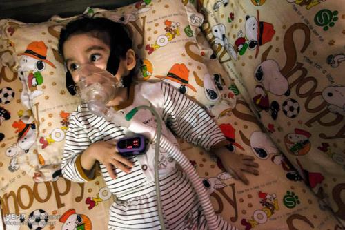 بیماری SMA قابل درمان شده است