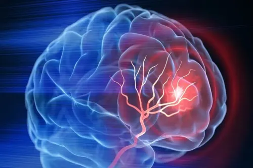 آلزایمر همیشه ارثی نیست مراقبت های روزمره نقش کلیدی دارند