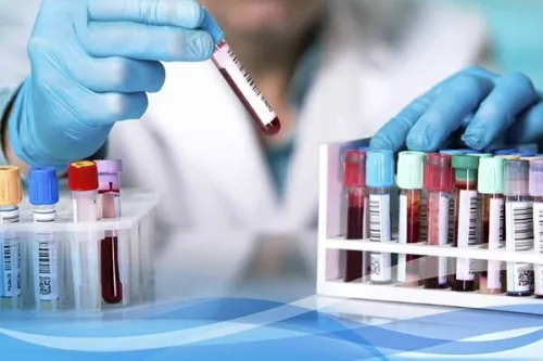 اعتماد اتحادیه اروپا به لابراتوار های مرجع ایران