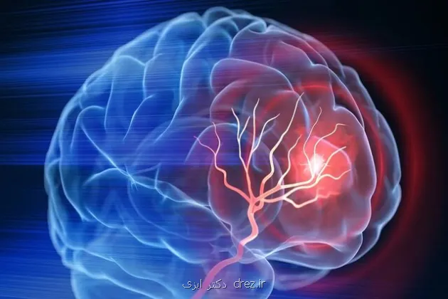 آلزایمر همیشه ارثی نیست مراقبت های روزمره نقش کلیدی دارند