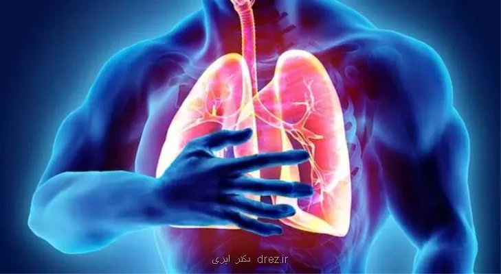 پنوموکوک، سپر تازه کودکان ایرانی در مقابل عفونت های ریوی