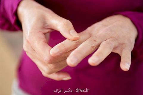 ترك سیگار سبب كاهش ریسك مبتلاشدن به آرتروز می شود