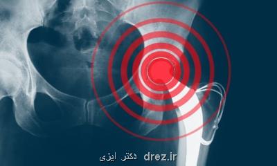 3 سفارش كلیدی درباره پوكی استخوان