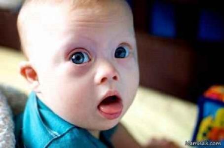 شدت بیماری كووید ۱۹ در معلولان ذهنی بیشتر است