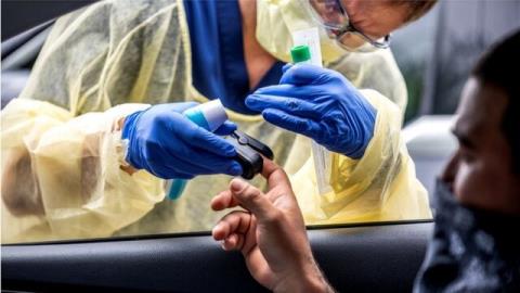 شناسایی بیشتر از 60 هزار مورد كرونا در آمریكا طی یك روز